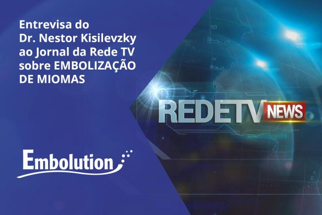 Entrevista Dr. Nestor no Jornal RedeTV News sobre -Tratamento de Mioma Uterino – Embolution Entrevista Dr. Nestor no Jornal RedeTV News sobre -Tratamento de Mioma Uterino - Embolution
