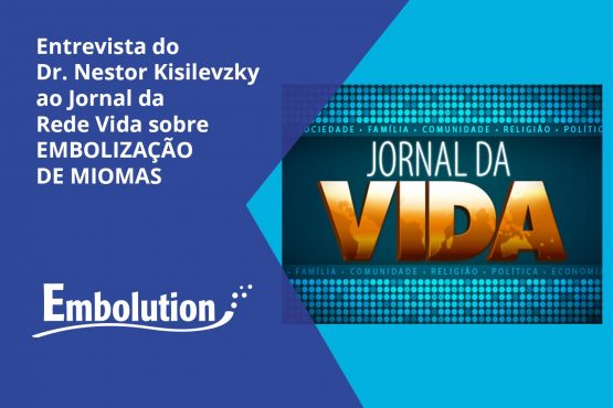 Entrevista Dr. Nestor no Jornal da Rede Viva sobre Tratamento de Mioma Uterino - Embolution