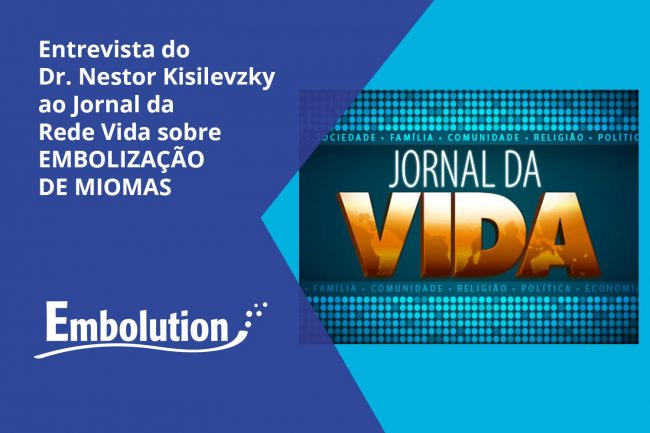 Entrevista Dr. Nestor no Jornal da Rede Viva sobre  Tratamento de Mioma Uterino – Embolution Entrevista Dr. Nestor no Jornal da Rede Viva sobre Tratamento de Mioma Uterino - Embolution