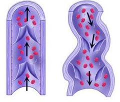 Sistema de valvulas dentro das veias - Embolution